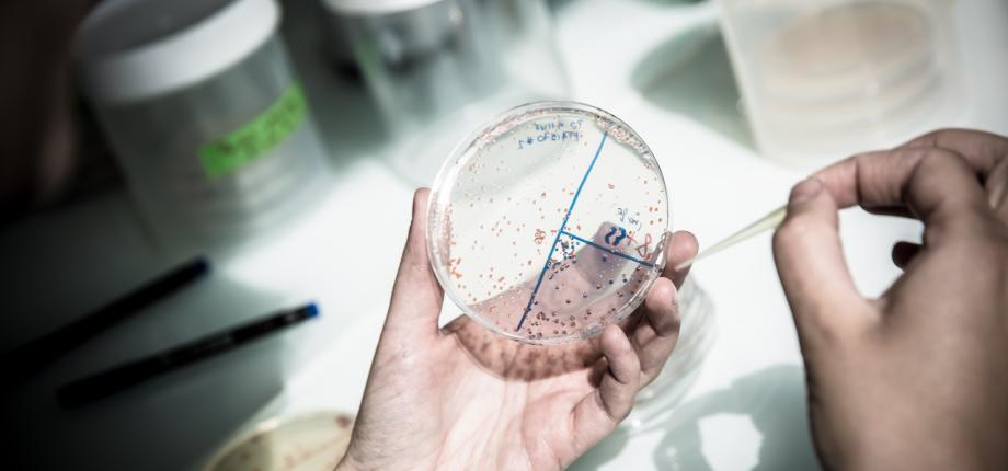 Enzyme mechanics, a lever for action against antimicrobial resistance